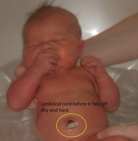 bathing a newborn with umbilical cord